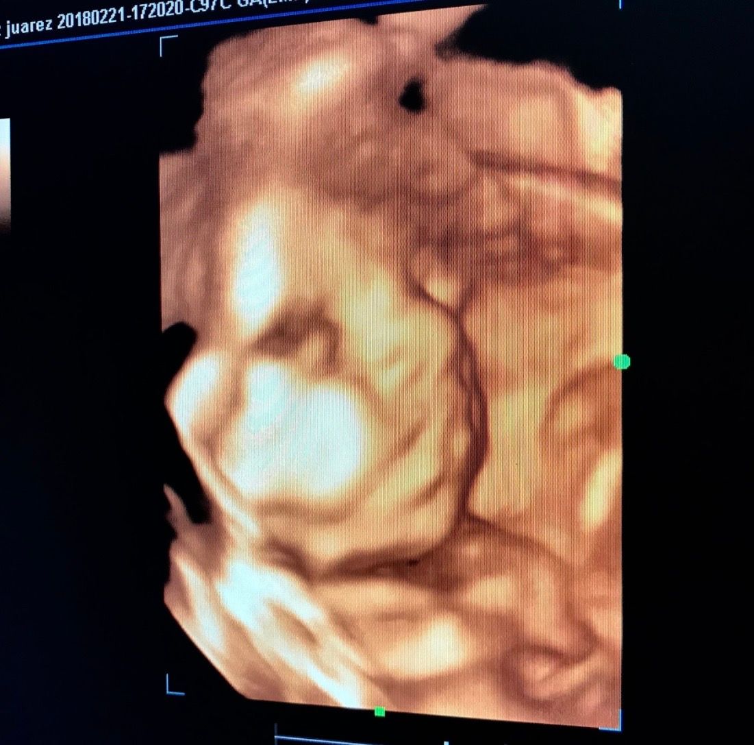 Luis Reynerio Téllez Gómez-9