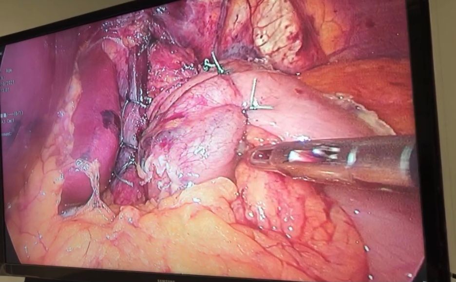 Juan Manuel Rangel Pizarro-11