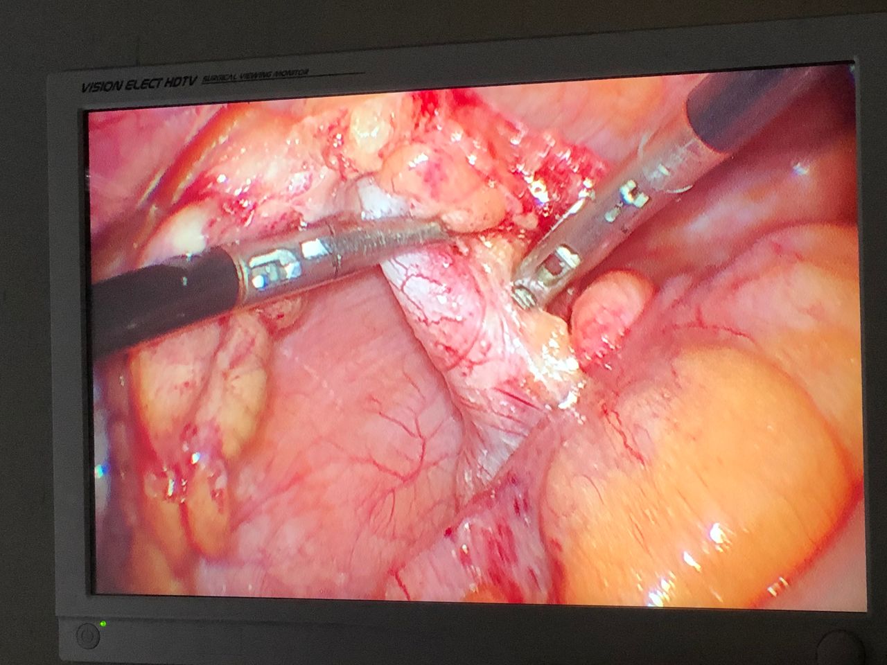 Ismael Gonzalez Torres-3