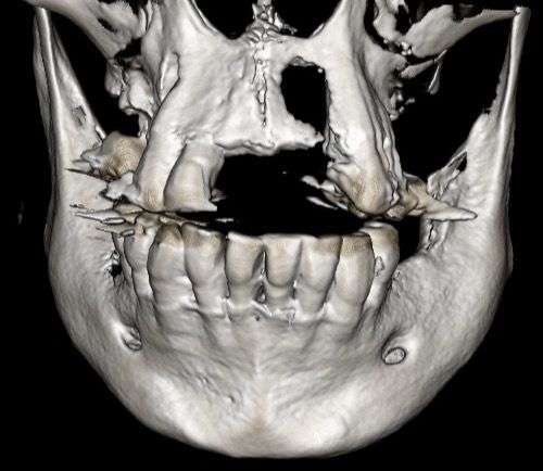 Marco Antonio Martinez Vasquez-3