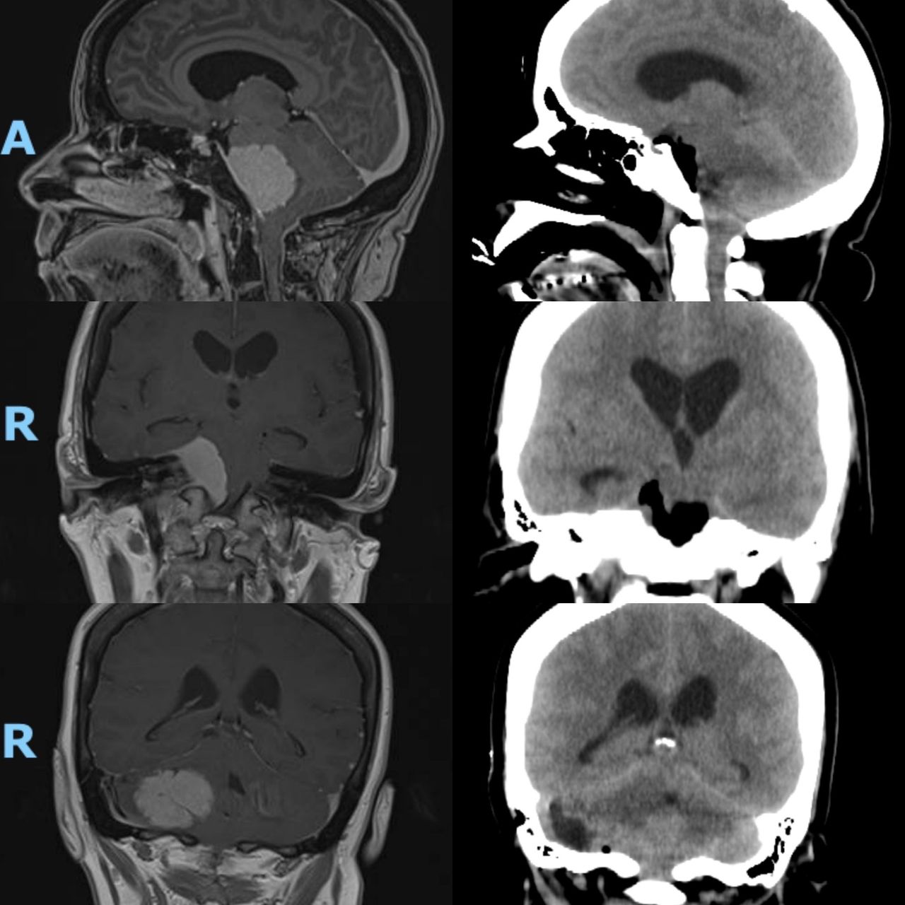 Celia Teresa De Jesús Álvarez Gamiño-20