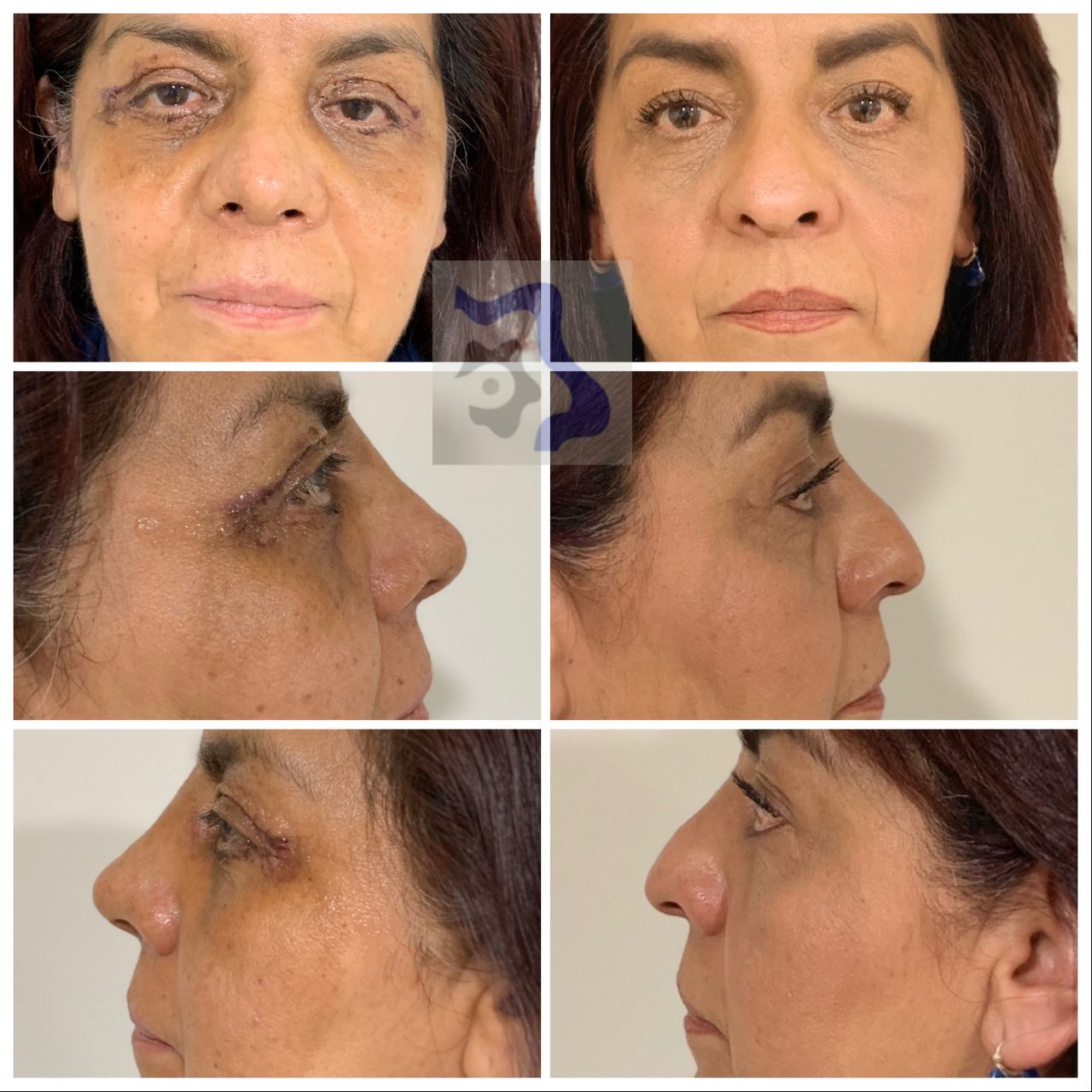 Cesar Alfonso Gutierrez Espinosa-8