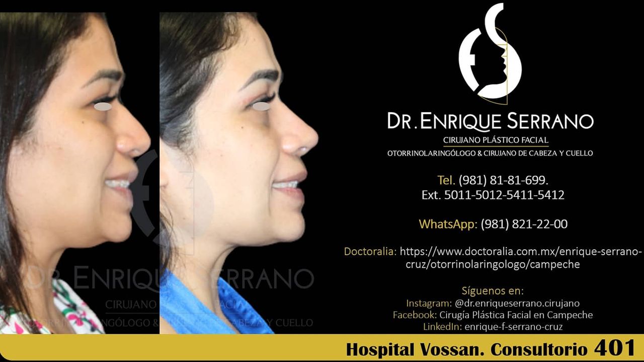 Enrique Serrano Cruz-106