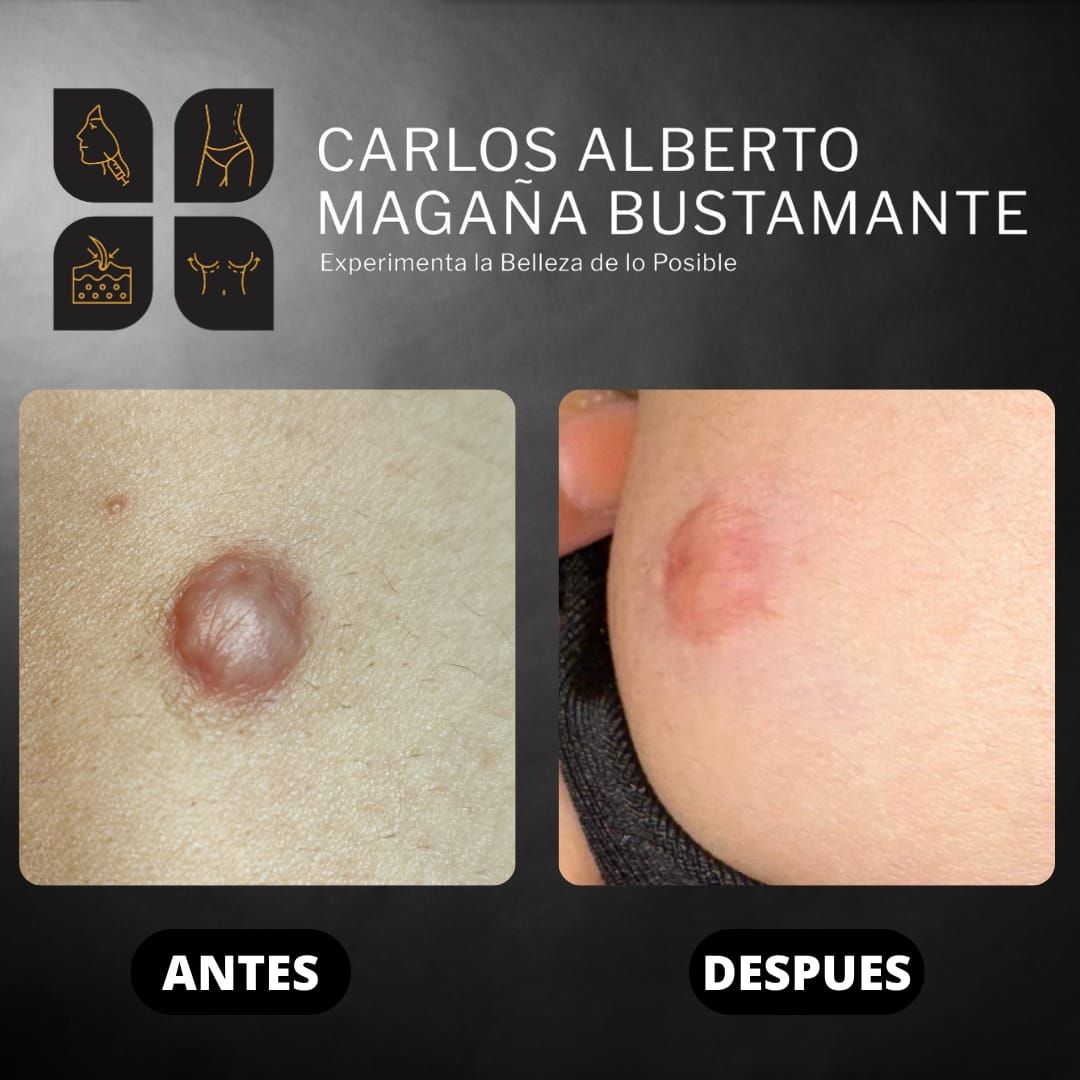 Carlos Alberto Magaña Bustamante-41