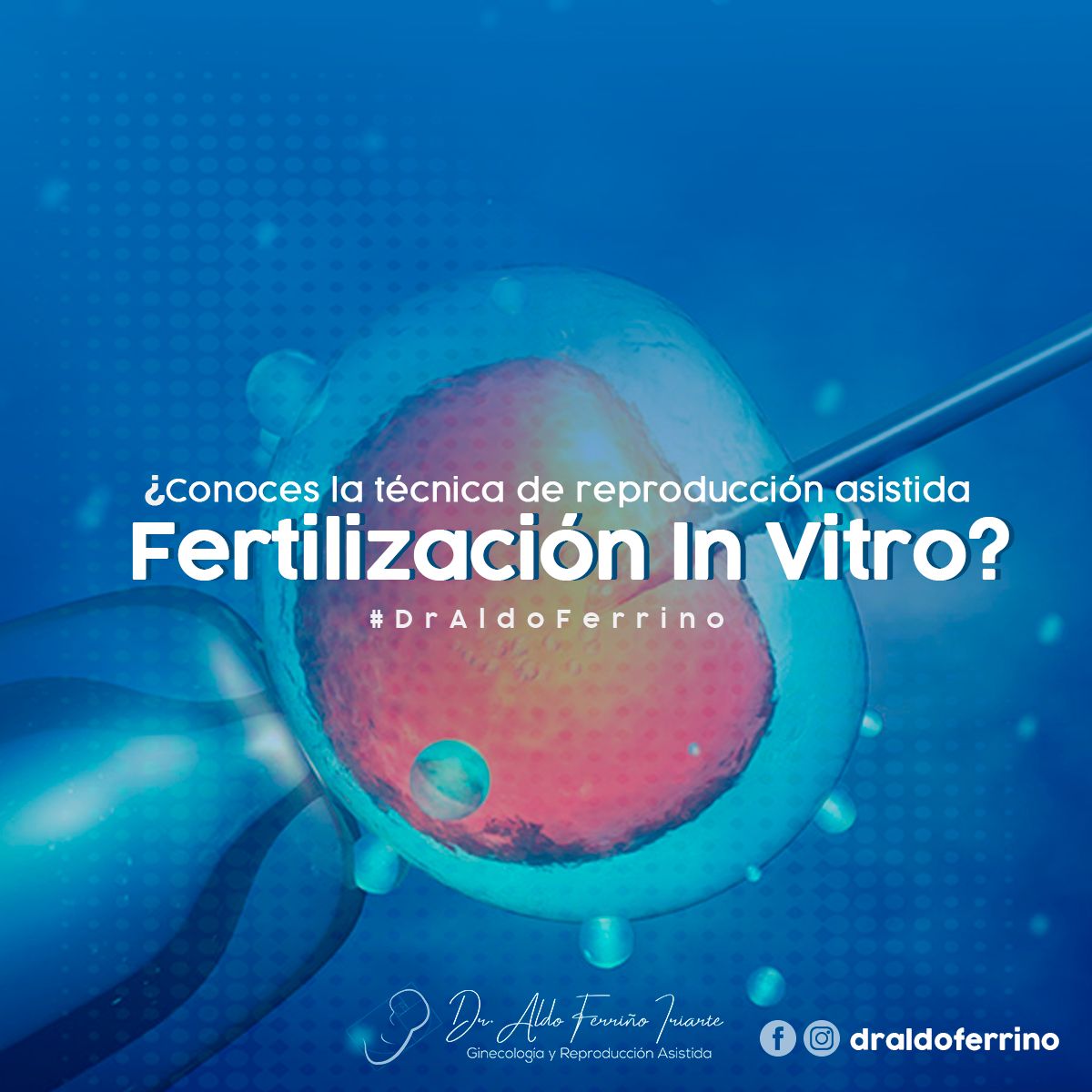 Aldo Ferriño Iriarte-0