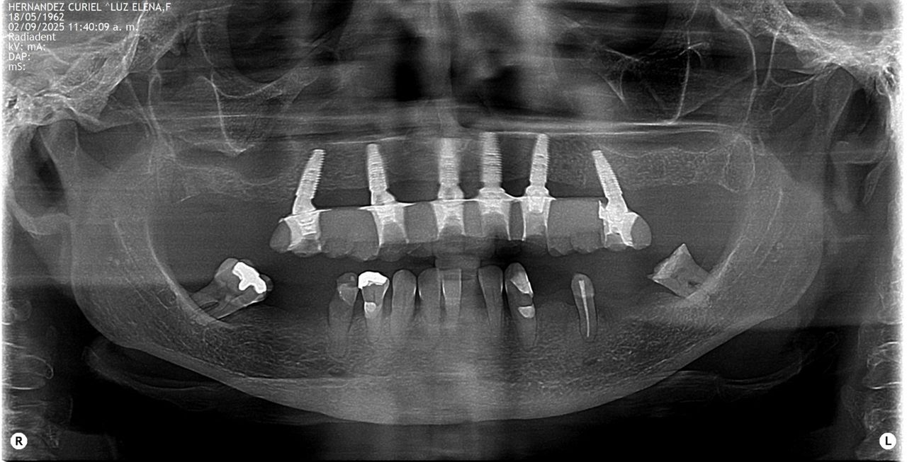 Guillermo García Garduño-26