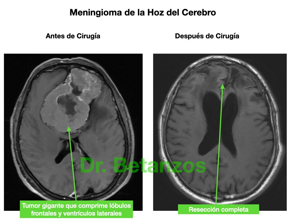 Aleixandre Betanzos Villegas-12