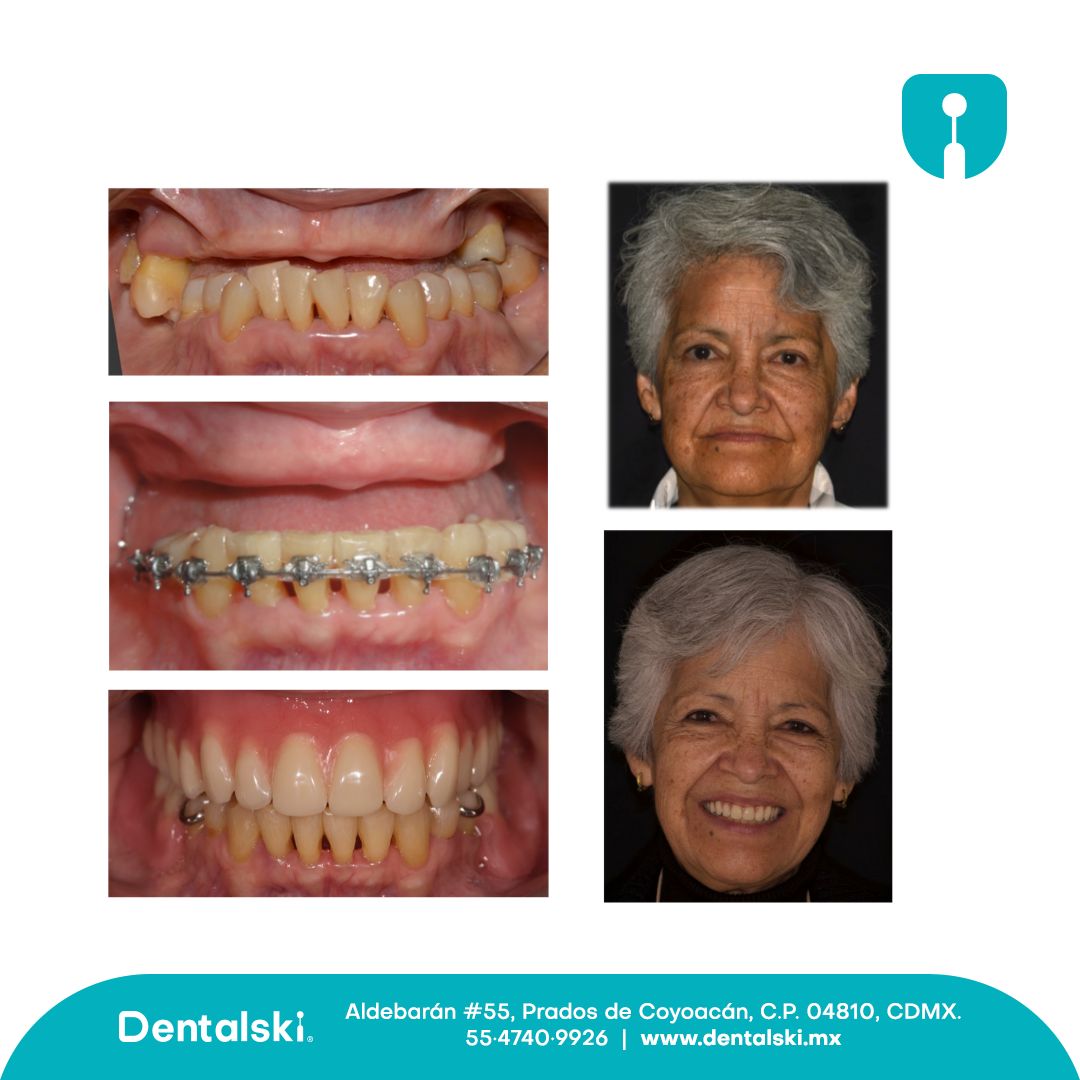 Hugo Gael Méndez Pérez-5