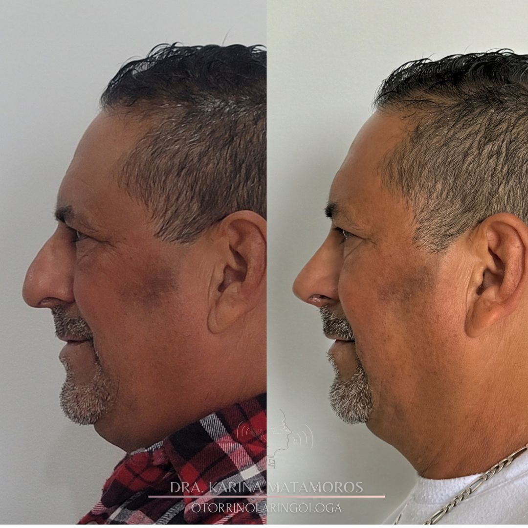 Ana Karina Matamoros Conejo-8