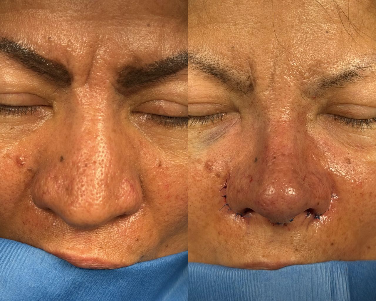 Angel Castro Urquizo-62