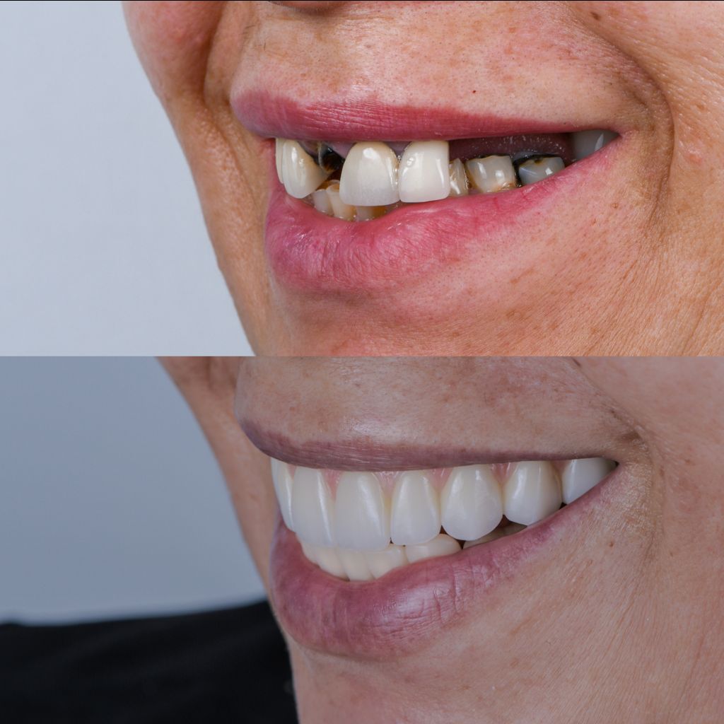 Ricardo López Lemus-135