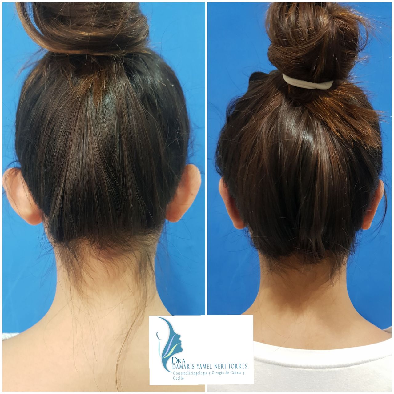 Damaris Yamel Neri Torres-5