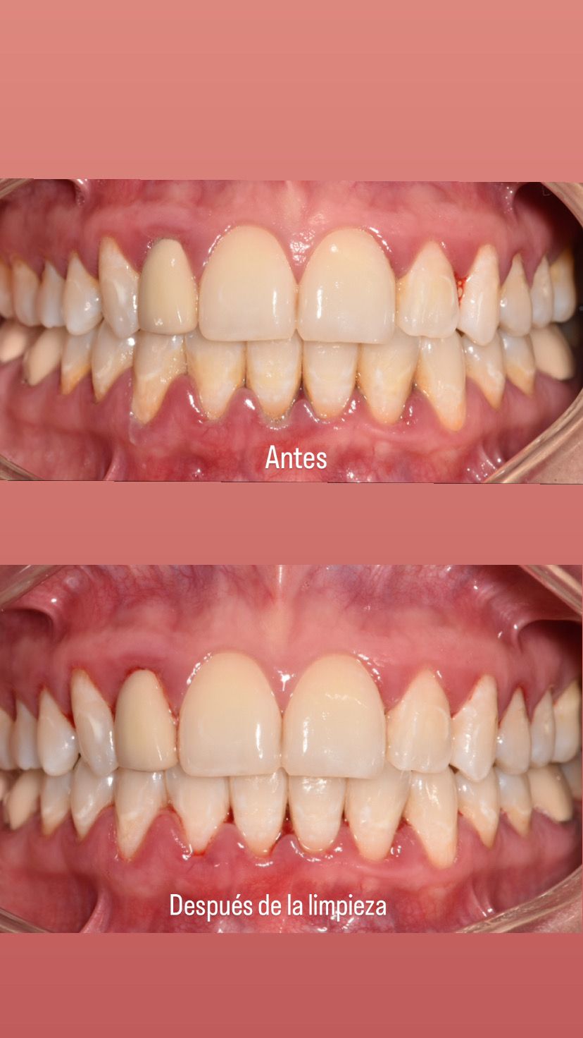 Cinthya Arelí Hernández Ramírez-7