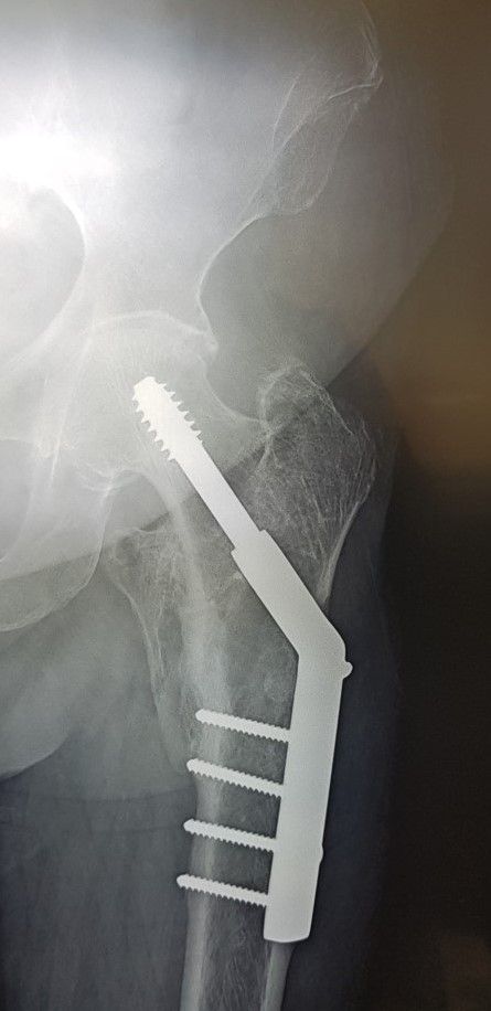 Gilberto Hernández Ortega-46