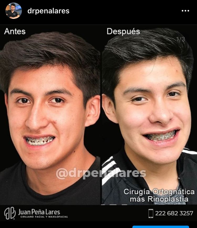 Juan Peña Lares-47