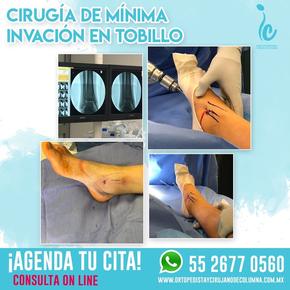 Juan Carlos Flores Raya-14