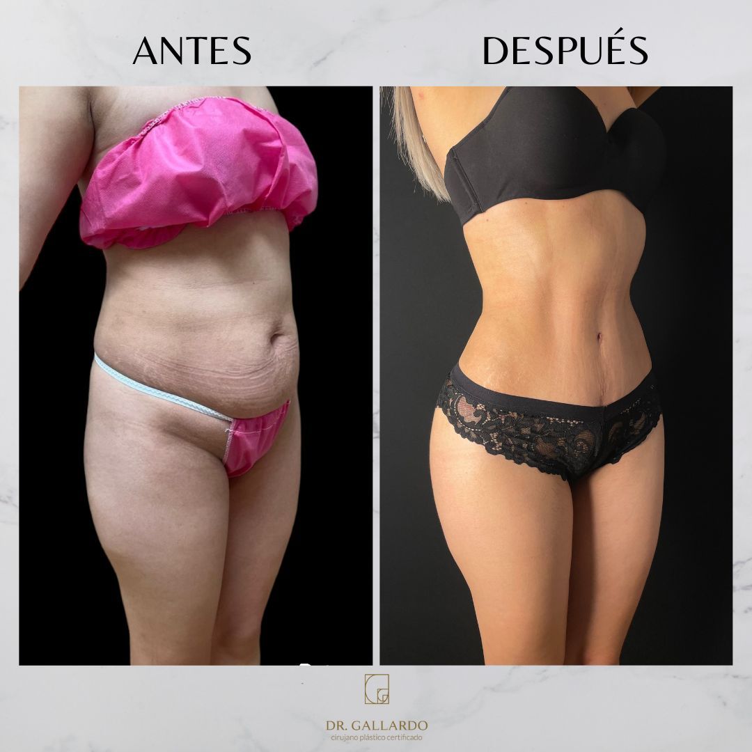 Fernando Gallardo-10