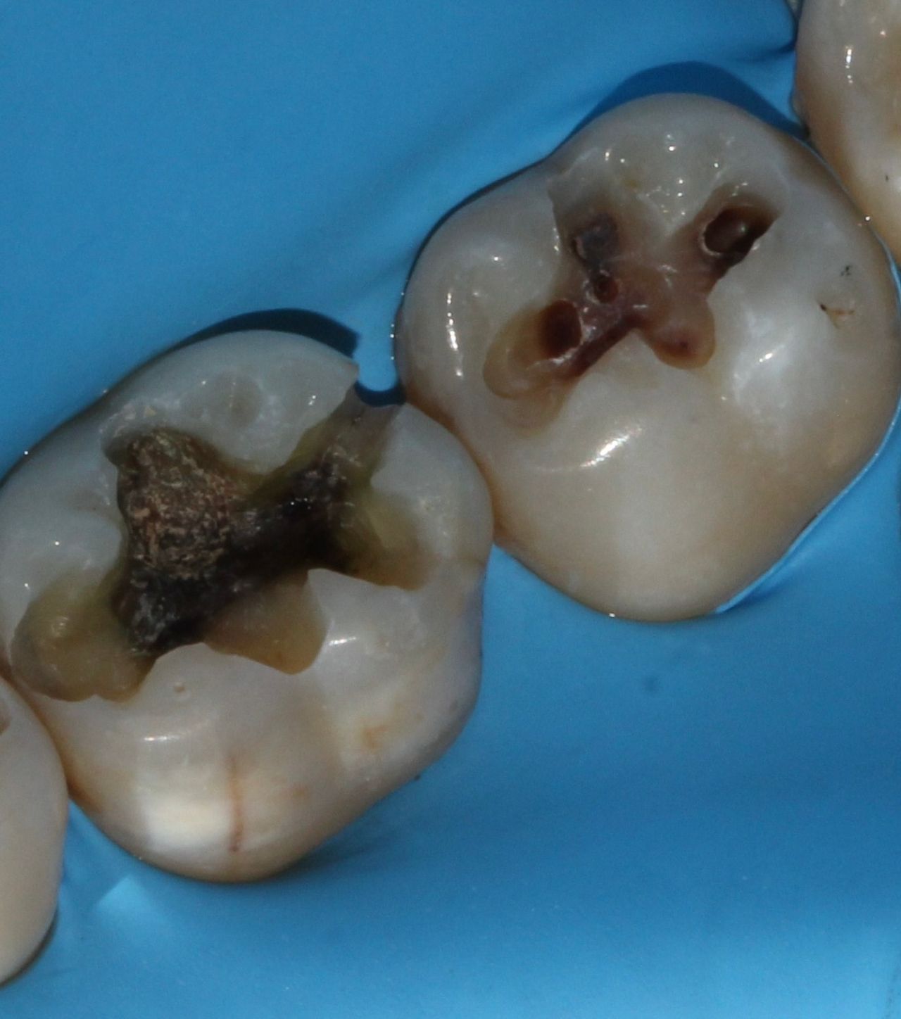 Karla Alvarez Treviño-7