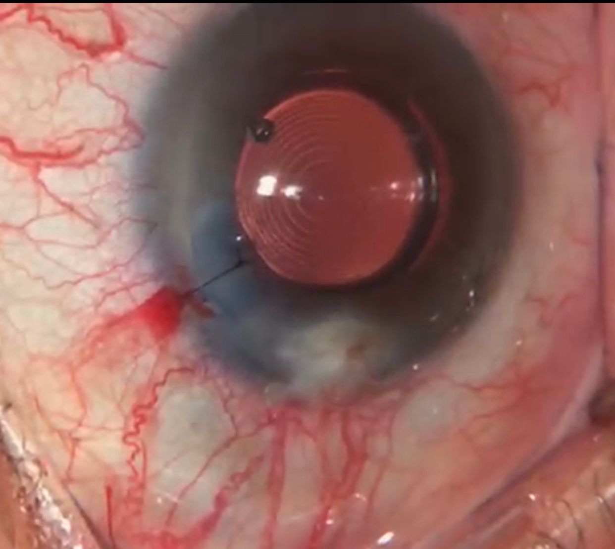 Blanca Esmeralda Hurtado Noriega-0