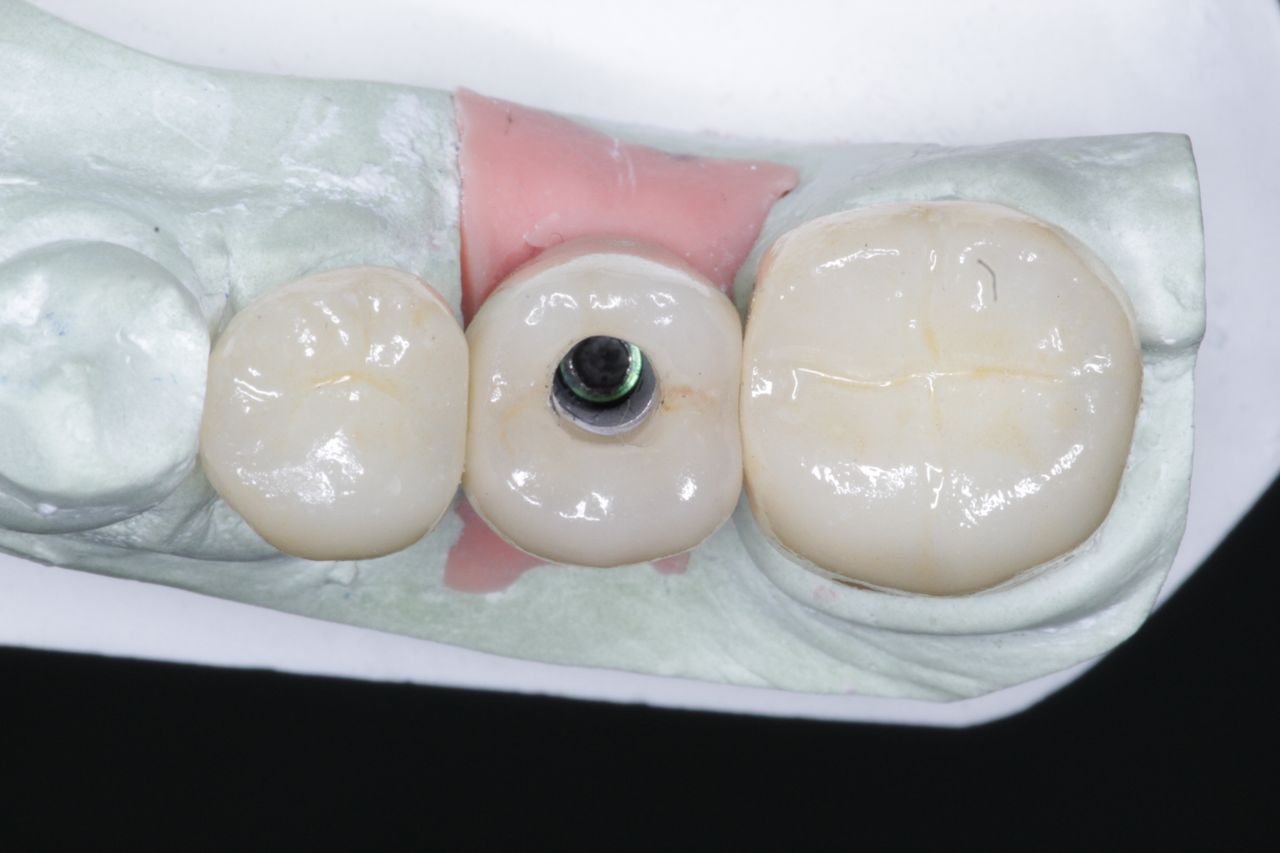 Josué Márquez Gómez-193