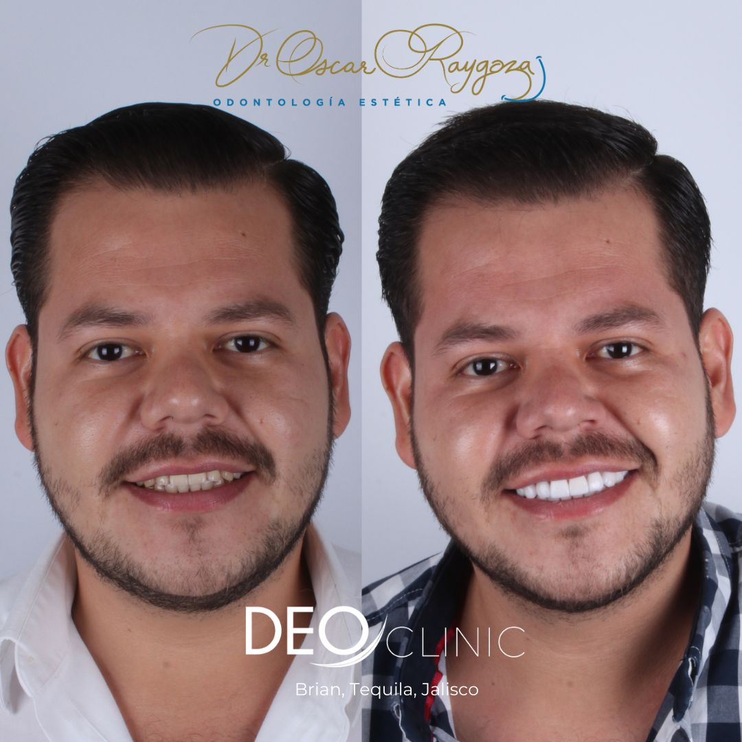 Oscar Raygoza Carrillo-35