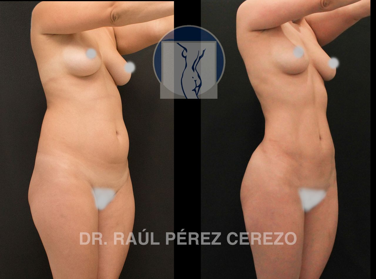 Raúl Pérez Cerezo-13