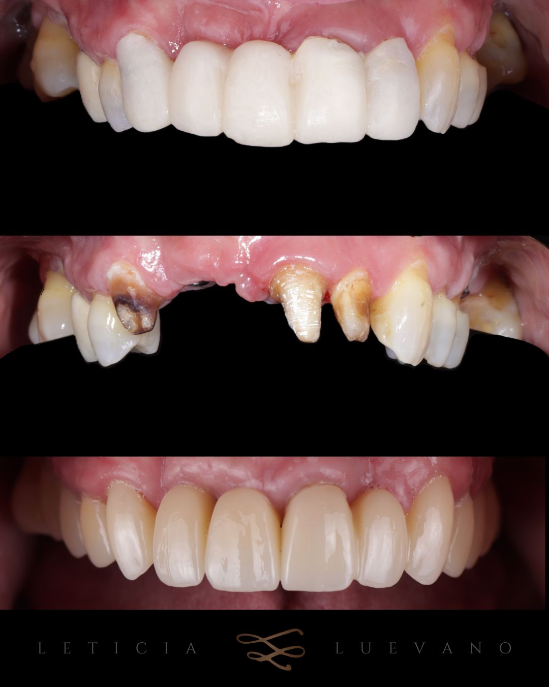 Leticia Isabel Luevano Lozada-1