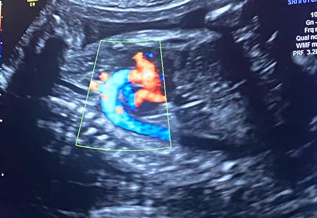 Lourdes Vianey Zaldivar Estrada-13