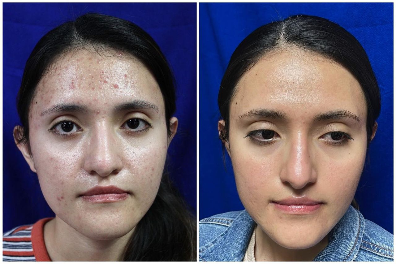 Adrián Martínez Moreno-13