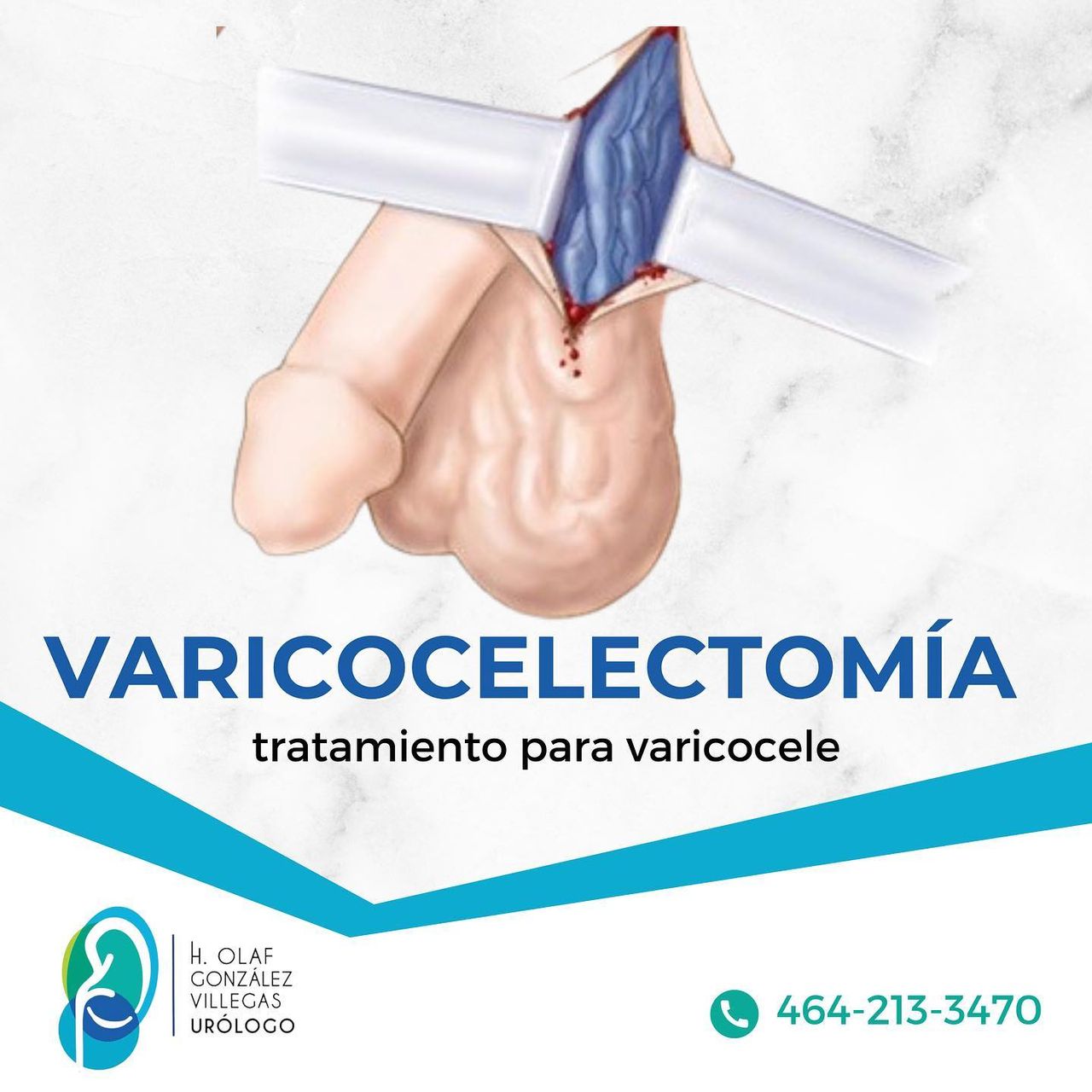 H.olaf Gonzalez Villegas-11