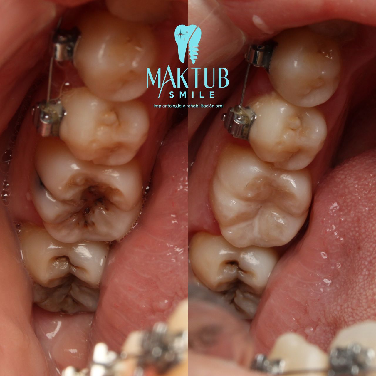 Nairoby Contreras-18