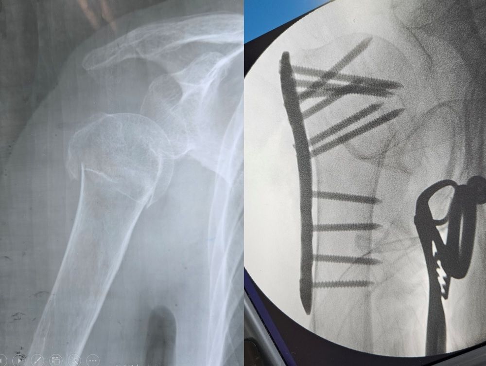 Luis Castañón Robles-4