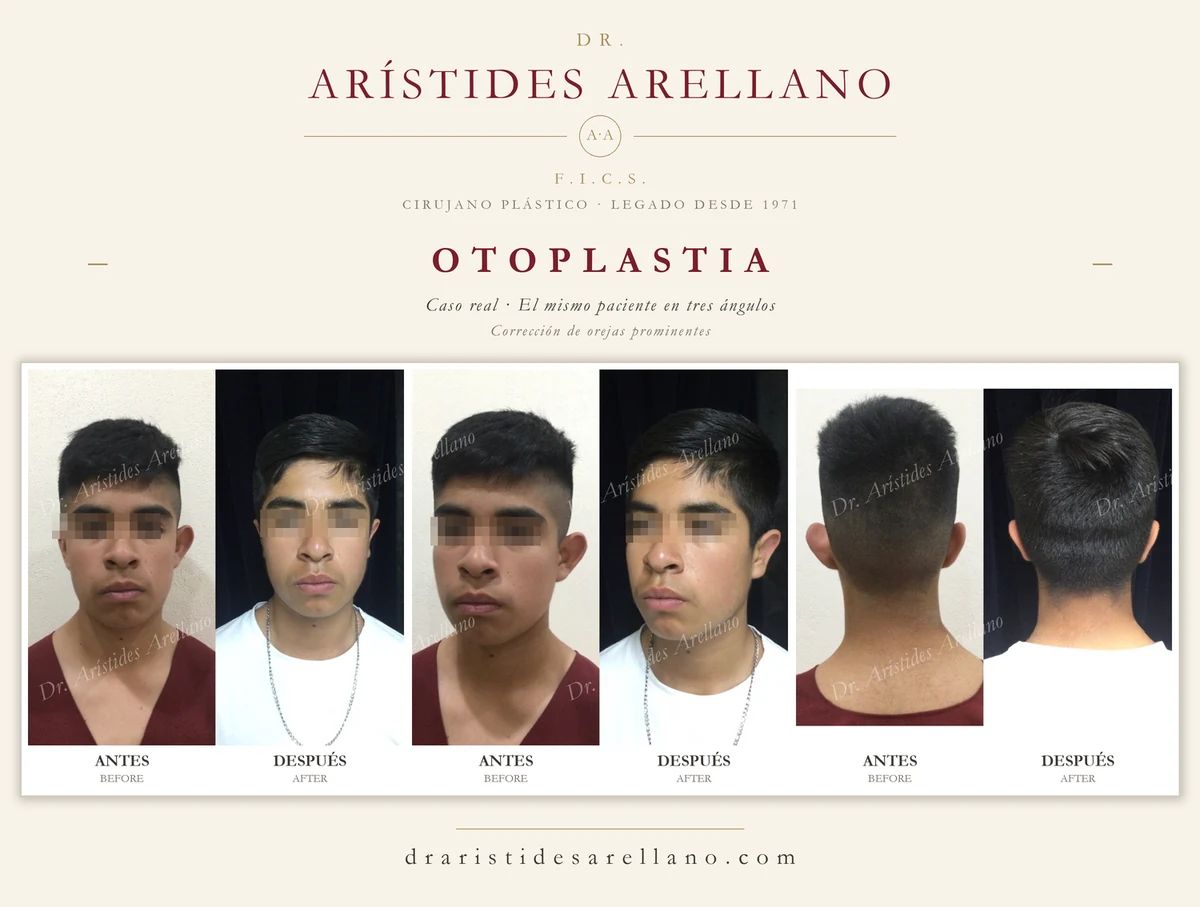 Arístides Arellano Huacuja-37