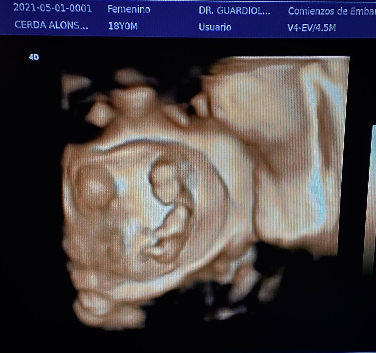 Eduardo Guardiola García-31