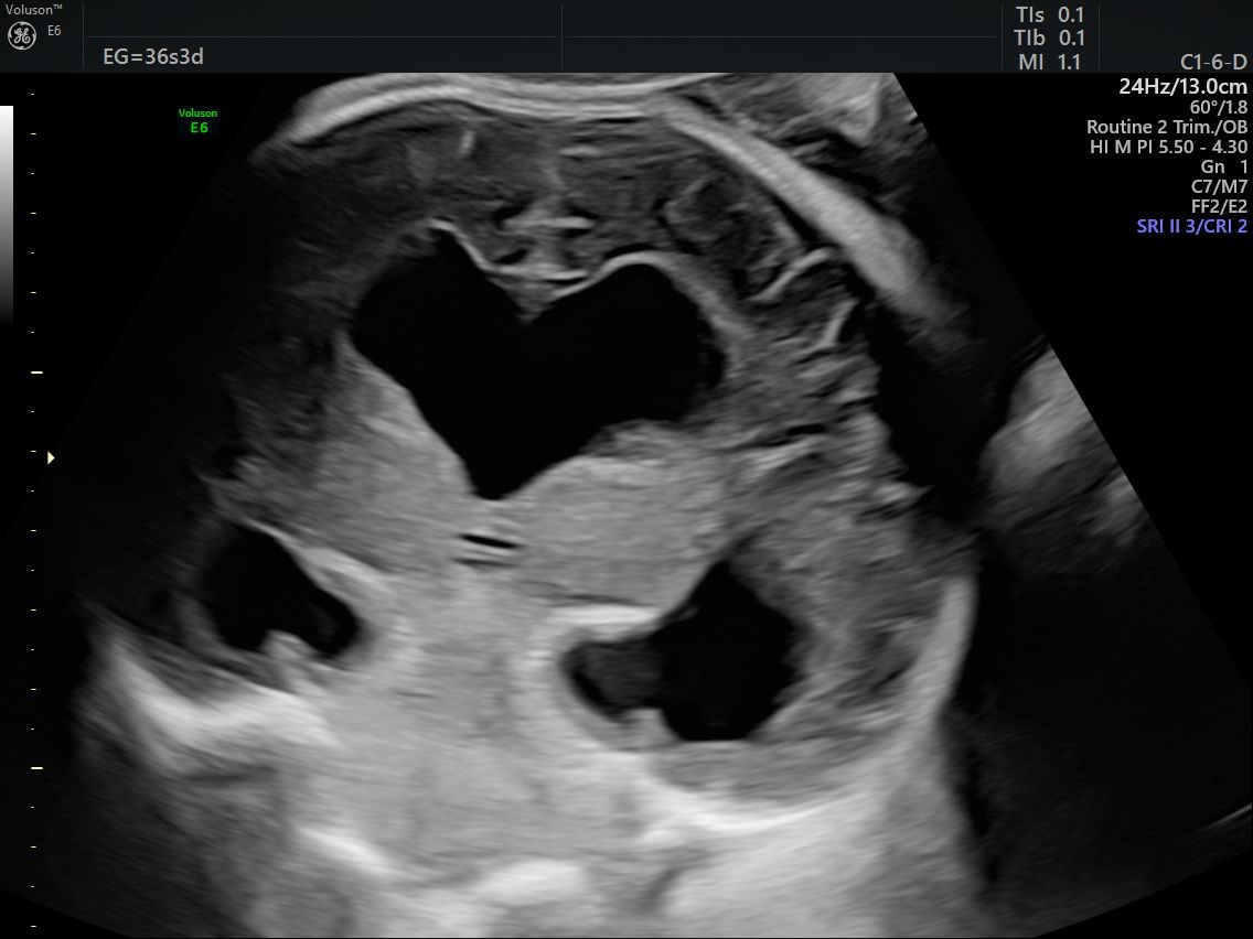 Guillermo Abrego Rodríguez-14