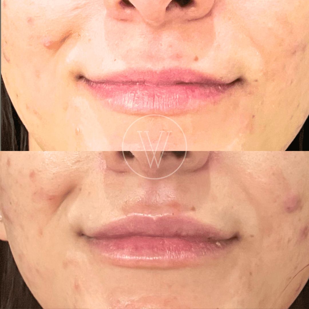 Stella Villarreal Garza-1