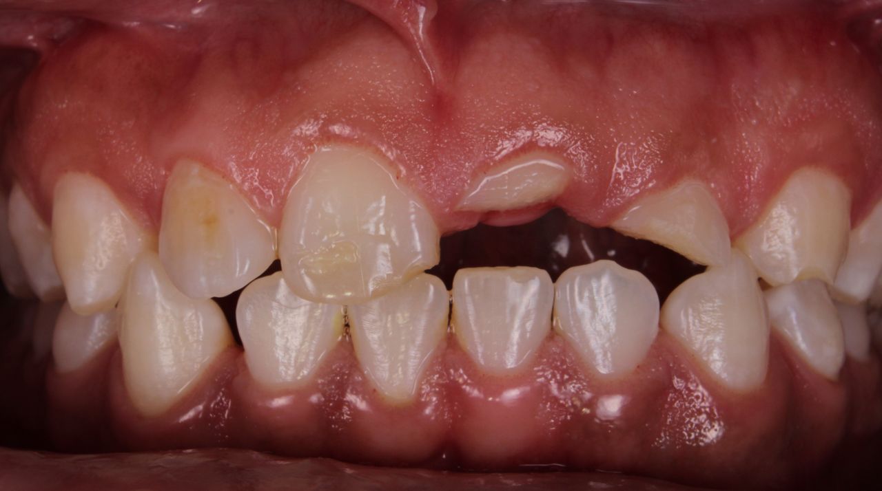 Fernando Fuentes Lozada-5