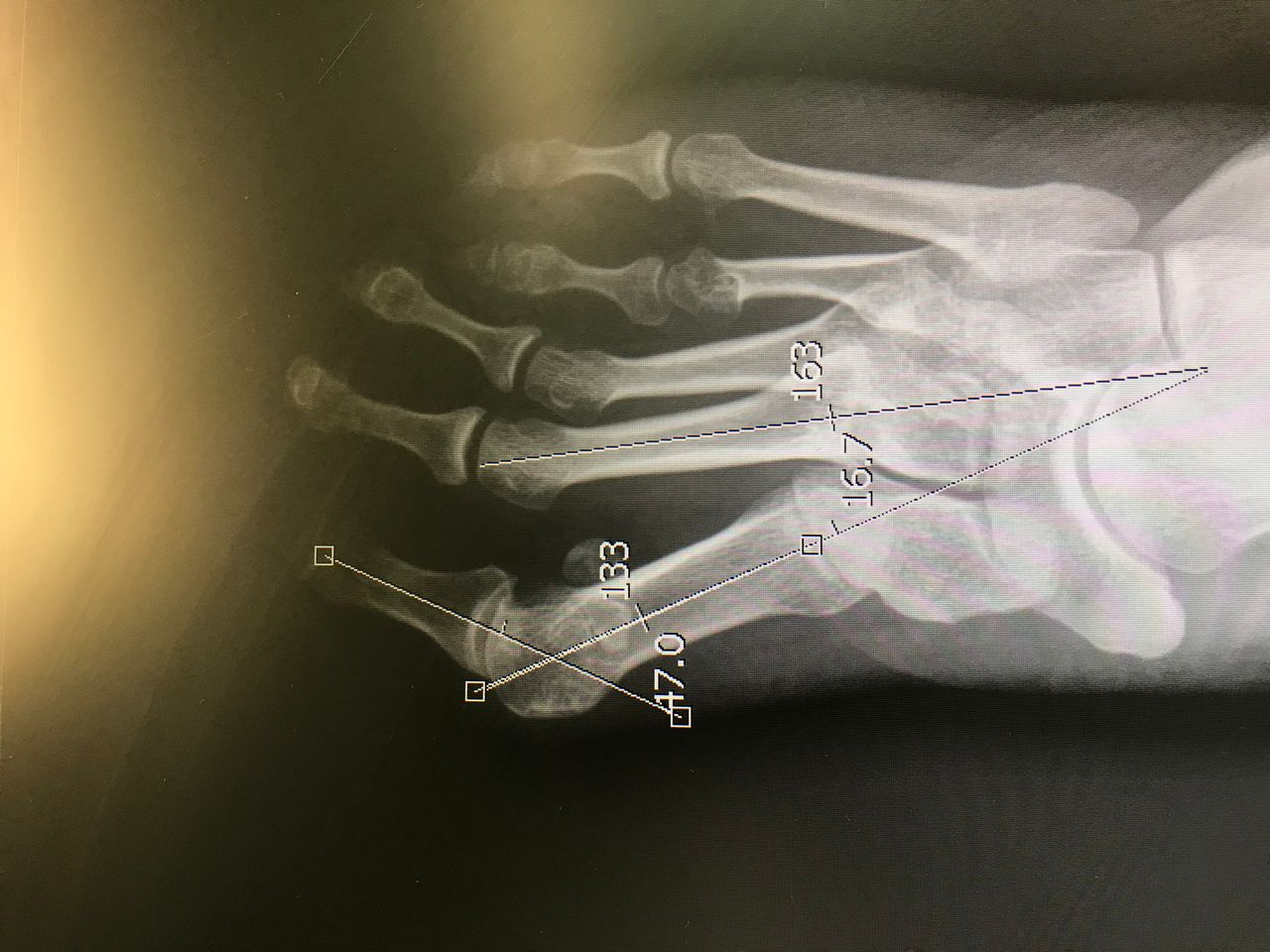 Carlos Alberto Romero Sosa-2