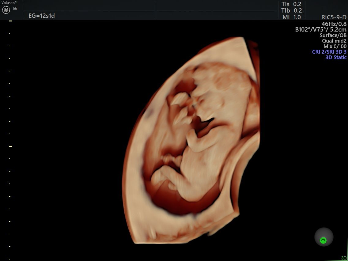 Guillermo Abrego Rodríguez-9