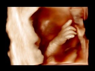 Miguel Franco Estrada-9