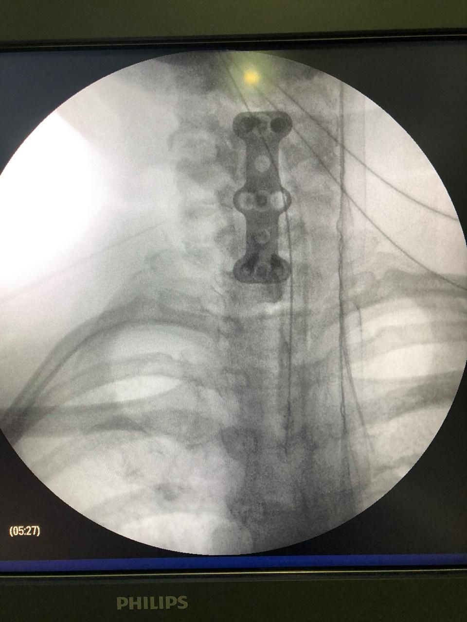 Juan José Luévano De La Cruz-12