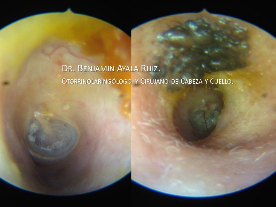 Benjamin Antonio Ayala Ruiz-36