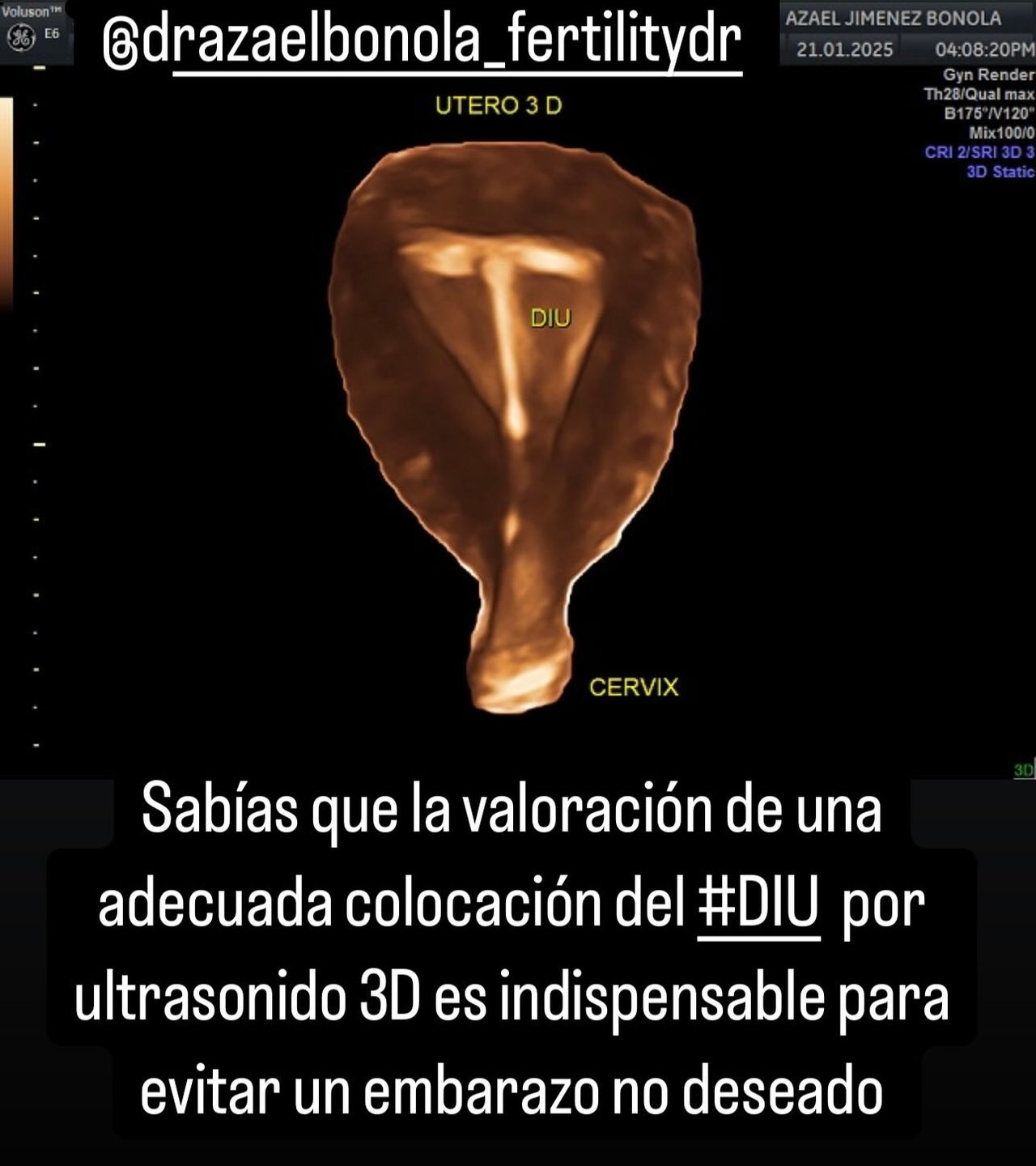 Azael Jiménez Bonola-9