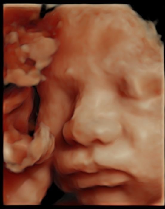 Abraham González Rodríguez-9