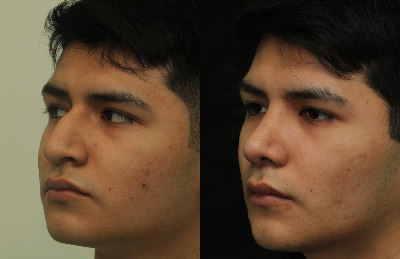 Angel Castro Urquizo-192