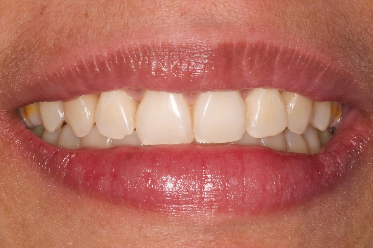 José Alberto Martínez Basulto-23