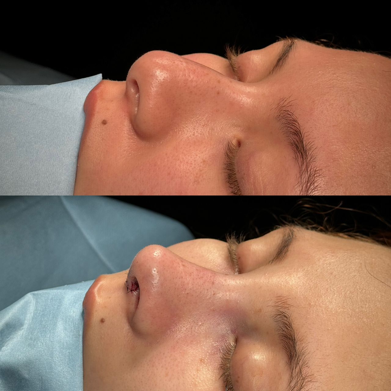 Angel Castro Urquizo-139