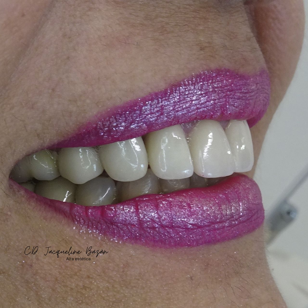 Jacqueline Bazán Díaz-24