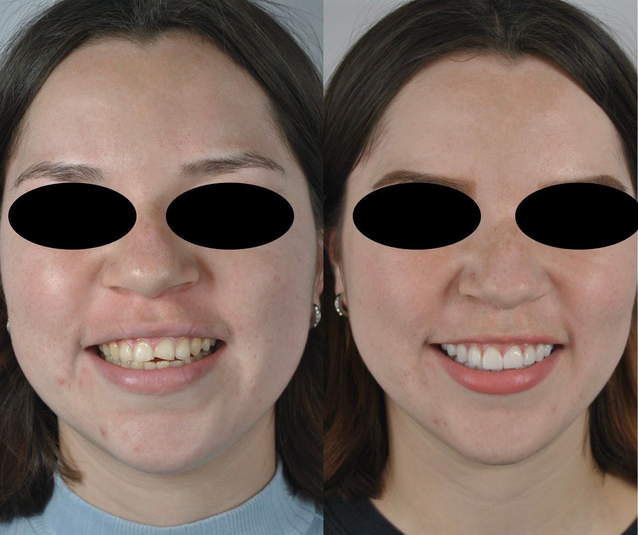 Joel Alejandro Sánchez Zúñiga-5