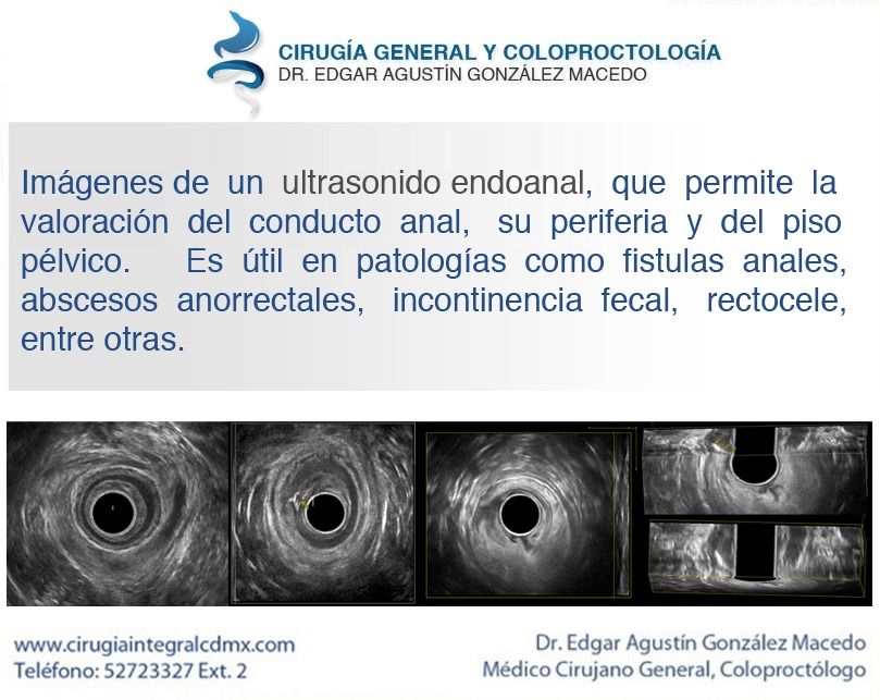 Edgar Agustín González Macedo-16